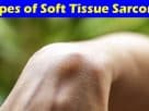 Complete Information About Types of Soft Tissue Sarcoma